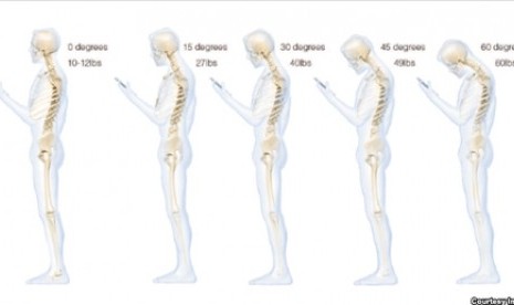 Gambar ini menunjukkan tekanan yang ditanggung oleh leher dan tulang punggung sebagai hasil menunduk untuk melihat smartphone 