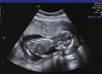 [imagetag] Subhanallah, Inilah Mukjizat Alquran tentang Jenis Kelamin Bayi