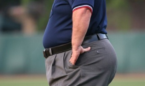 Obesitas (Ilustrasi)