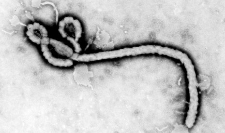 Virus Ebola (ilustrasi).
