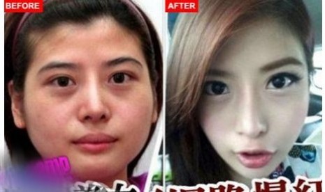 Sebelum Operasi Wajah Wajah Artis Korea Sebelum Dan Sesudah Operasi Sebelum Operasi Wajah Wajah Artis Korea Sebelum Dan Sesudah Operasi