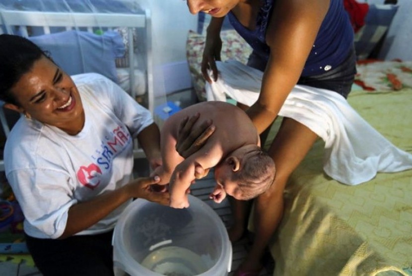 Pijat India Membuat Bayi Mikrosefalia Lebih Tenang 