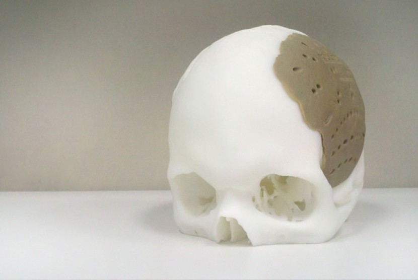 Peneliti biomedis pada University of Sydney sedang menguji pengganti tulang jenis baru dengan menggunakan mesin pencetak tiga dimensi atau printer 3D.