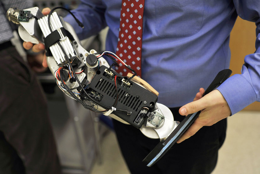  Peneliti Pusat Institut Rehabilitasi Chicago untuk Kedokteran Bionic, memegang kaki palsu eksperimental \