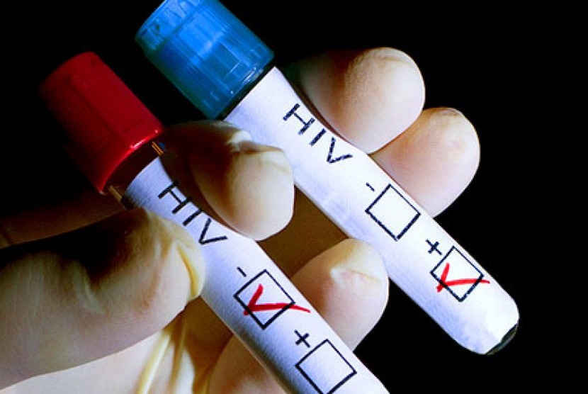 Positif mengidap HIV (ilustrasi)
