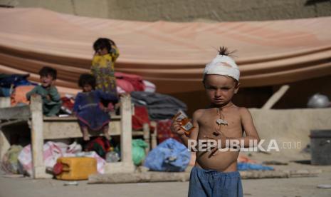 Bocah laki-laki yang terluka berdiri di depan tempat penampungan darurat setelah gempa bumi di desa Gayan, di provinsi Paktika, Afghanistan, Jumat 24 Juni 2022. Gempa kuat melanda wilayah pegunungan yang berbatu di Afghanistan timur Rabu pagi, meratakan rumah-rumah dari batu dan bata lumpur dalam gempa paling mematikan di negara itu dalam dua dekade, kantor berita pemerintah melaporkan. Kemenkes Afghanistan Peringatkan Wabah Kolera di Antara Korban Gempa