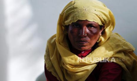 Seorang pengungsi Rohingya beristirahat di rumah penampungan sementara setelah mendarat di pesisir Ladong, Aceh. Direktur Hak Asasi Manusia (HAM) dan Kemanusiaan Kementerian Luar Negeri (Kemenlu) RI Achsanul Habib menjelaskan bahwa ratifikasi Konvensi PBB tahun 1951 harus dirembuk dalam konsensus nasional. Untuk menjadi sebuah negara yang menerapkan konvensi tersebut diperlukan beberapa prasyarat, seperti, adanya urgensi dan prioritas.