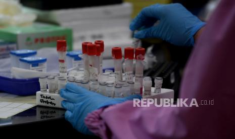 Petugas mengecek spesimen tes usap PCR di Labkesda. Ilustrasi