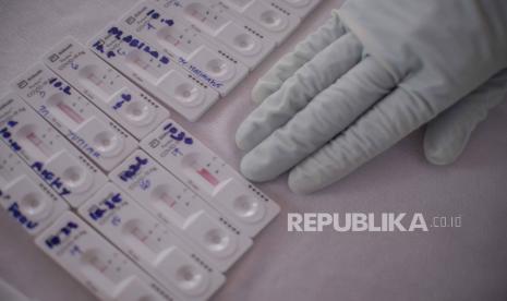 Sejak ketentuan wajib rapid test antigen dilakukan, tercatat ada puluhan penumpang KA yang tidak bisa melakukan perjalanannya. Kepala PT Kereta Api Indonesia (KAI) Daop 5 Purwokerto Agus Setiyono, menyebutkan hingga Kamis (25/12) siang tercatat ada sebanyak 29 calon penumpang yang rapid tes antigennya menunjukkan hasil reaktif.