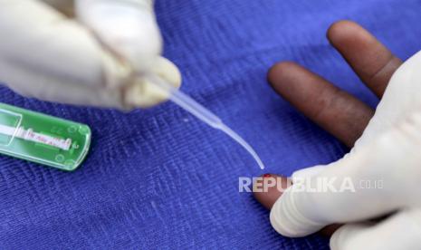 Bangladesh mencatat 1.276 kasus dan 266 kematian HIV sepanjang 2023 (Foto: ilustrasi tes HIV)