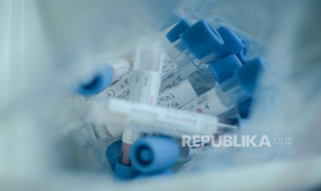 Tabung cairan hasil tes usap Polymerase Chain Reaction (PCR). Ilustrasi