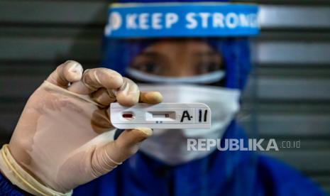 Petugas medis menunjukkan hasil negatif pada alat diagnostik cepat (rapid test) Covid-19, ilustrasi