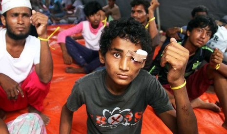 Warga etnis Rohingya yang terdampar di perairan pantai Langsa menunjukkan tanda pengenal berupa gelang tangan bewarna kuning di tempat penampungan sementara Kuala Langsa, Aceh, Sabtu (16/5).