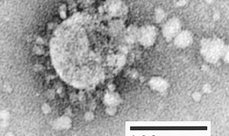 Virus Corona. Seorang WNA dari Hubei, China, dirawat di Cirebon setelah mengalami gejala demam hingga sakit tenggorokan.