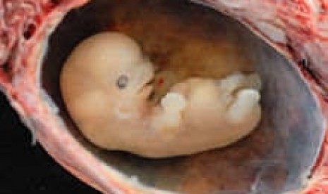 A complete spontaneous abortion at about 6 weeks from conception (illustration)