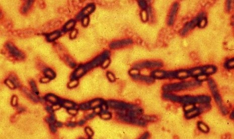 A microscopic picture of spores and vegetative cells of Bacillus anthracis which causes the disease anthrax is pictured in this undated file photograph.