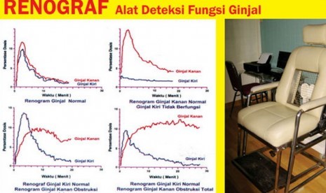 Alat renogram dan hasil deteksi ginjalnya, renograf.