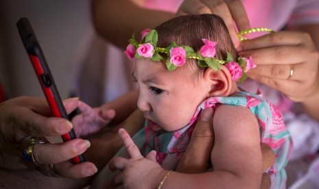 Ana Beatriz, bayi berusia empat bulan, yang terlahir dengan mikrosefalia diduga akibat virus zika di Brasil.