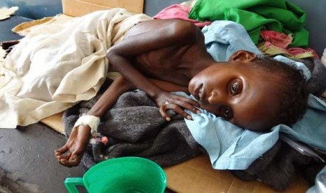 Anak kelaparan di Mogadishu, Somalia.