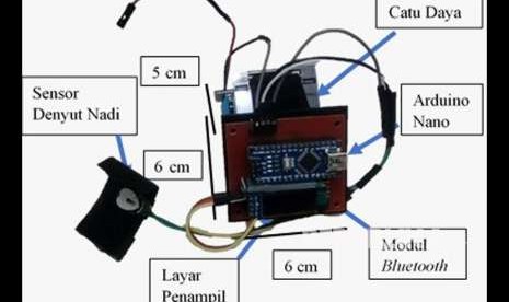 Arloji pendeteksi depresi karya mahasiswa Universitas Brawijaya (UB) Malang. 
