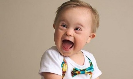 Asher Nash (16 bulan), bayi down syndrome yang akhirnya menjadi model produk Oshkosh