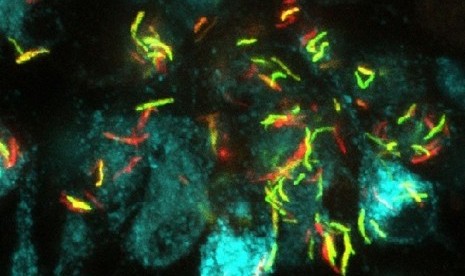 Bakteri Mycobacterium tuberculosis. Ilustrasi