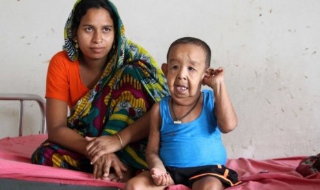 Bayezid Shikdar, anak dengan penyakit yang membuatnya tampak seperti orang tua.