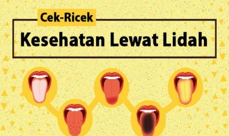 Cek ricek kesehatan lewat lidah