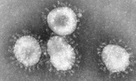 Coronaviruses are a group of viruses that have a halo, or crown-like (corona) appearance when viewed under an electron microscope.