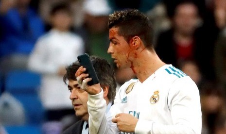 Cristiano Ronaldo memeriksa luka di wajahnya dengan telepon selular.