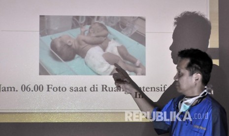 Paediatric surgeon Diki Drajat explained the process to separate conjoined-twins in a press conference at Hasan Sadikin Hospital, Bandung City, Tuesday (October 27).  