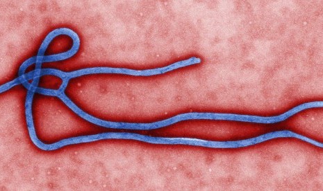 Electron micrograph of an Ebola virus virion (illustration)