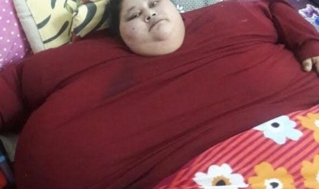 Eman Ahmed Abd El Aty, perempuan Mesir dengan berat ditaksir 500 kg