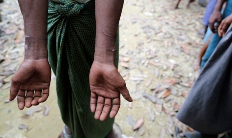 Etnis Rohingya ditangkap oleh tentara Myanmar dan kemudian dilepaskan, menunjukkan bekas luka di tangannya di sebuah desa Rohingya luar Maugndaw di negara bagian Rakhine, Myanmar 27 Oktober 2016. Gambar diambil 27 Oktober , 2016. 