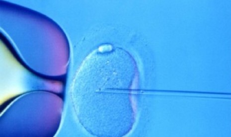 In vitro fertilization. 