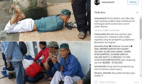 Foto pengemis pura-pura cacat di media sosial 