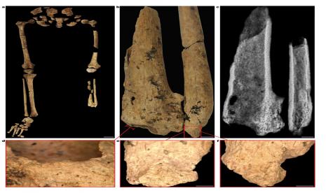 Foto temuan kerangka manusia Liang Tebo, Kalimantan Timur, yang diduga menjadi manusia pertama yang diamputasi.