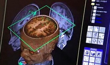 Ilmuwan dari Australian National University (ANU) berhasil menciptakan apa yang mereka sebut ‘otak dalam sebuah chip’, yang menggunakan semi konduktor untuk memandu pertumbuhan jaringan saraf menjadi koneksi yang bisa diprediksi.