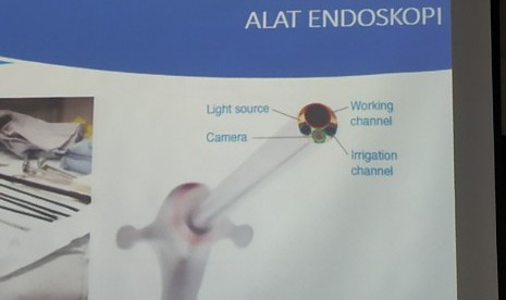 Ilustrasi alat endoskopi.