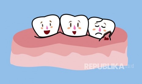 Penyakit periodontal seperti gingivitis dan periodontitis ternyata tak hanya berkenaan dengan kesehatan gigi dan mulut saja (Foto: ilustrasi gusi)