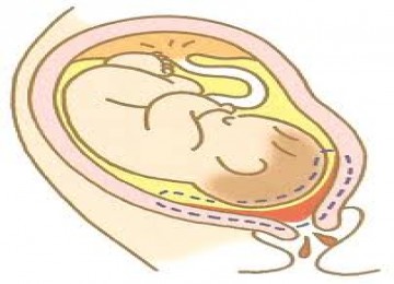 ilustrasi bayi dalam kandungan.