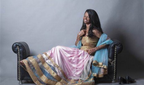 In this Aug. 4, 2014 photo provided by Rahul Saharan, Indian acid attack victim Laxmi, 22, poses during a fashion photo shoot in New Delhi, India. 