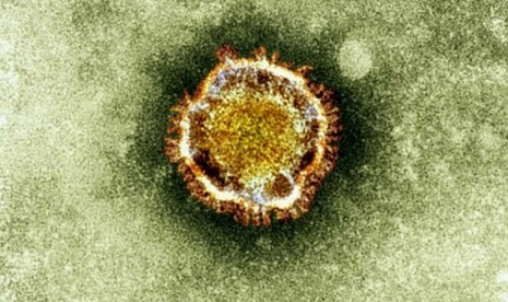 In this undated file image released by the British Health Protection Agency shows an electron microscope image of a coronavirus, part of a family of viruses that cause ailments including the common cold and SARS, which was first identified last year in the