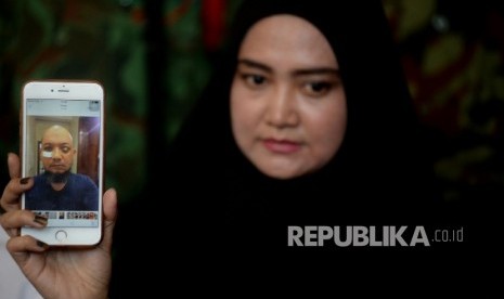 Istri penyiidik KPK Novel Baswedan, Rina Emilda menunjukan foto terbaru Novel saat memberikan keterangan pers di kediamannya, Jakarta, Senin (28/8). 