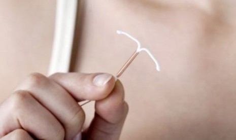 Kontrasepsi IUD. BKKBN menyebutkan program keluarga berencana (KB) dengan memakai alat kontrasepsi intrauterine device (IUD) atau spiral aman untuk digunakan.