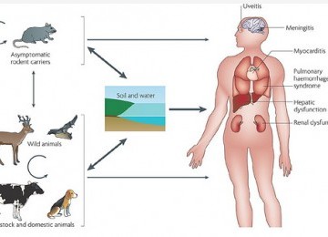 Leptospirosis (ilustrasi).