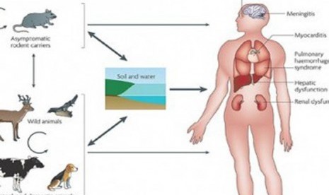 Leptospirosis (ilustrasi).