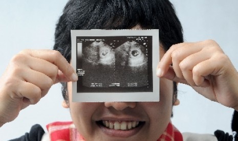 Foto USG janin. Ibu hamil dapat melakukan pemeriksaan USG lebih dari itu boleh dilakukan selama memang bermanfaat dan bisa dikerjakan.