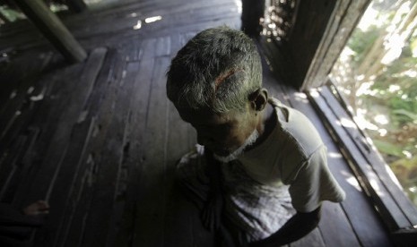 Muhammad Amin (62 years) a Muslim man who was beaten with a metal pipe until his skull cracked, sits in his home in Paik Thay, the site of recent violence between Muslim Rohingyas and Buddhist Rakhine people, November 2, 2012. Picture taken November 2.   