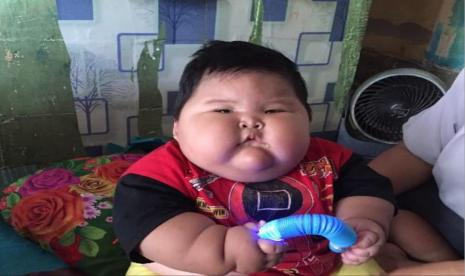 Bayi asal Kabupaten Bekasi, Jawa Barat, Muhammad Kenzi Alfaro, mengalami obesitas. Berat badannya 27 kilogram di usia 16 bulan.